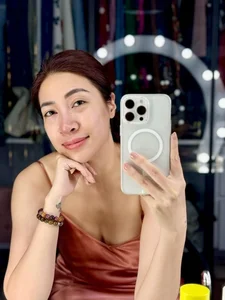 Cosmetic Surgery Risks: Vietnamese Celebrities Share Complications After Nose Jobs - image 2
