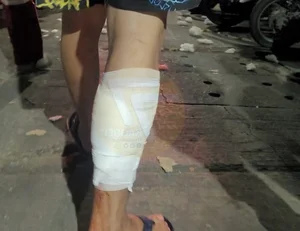 Shocking Encounter: Man Attacked by Giant Python While Urinating Outdoors - image 9