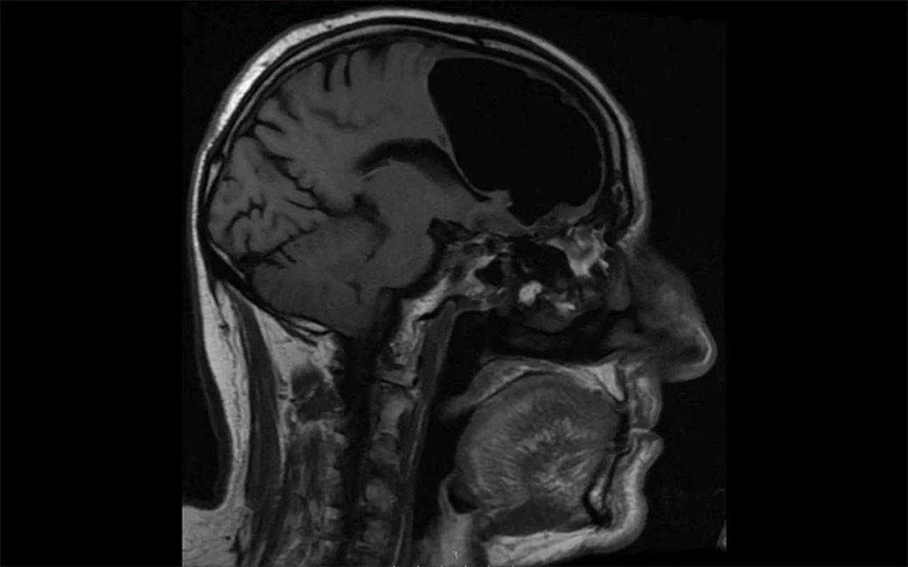 China's Ultra-High-Resolution Brain Scanner Project Explained